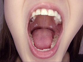 300人のおくち　3　サンプル画像02